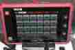 20989 Matco Tools Maxgo Automotive Computer Scan Tool Great Condition